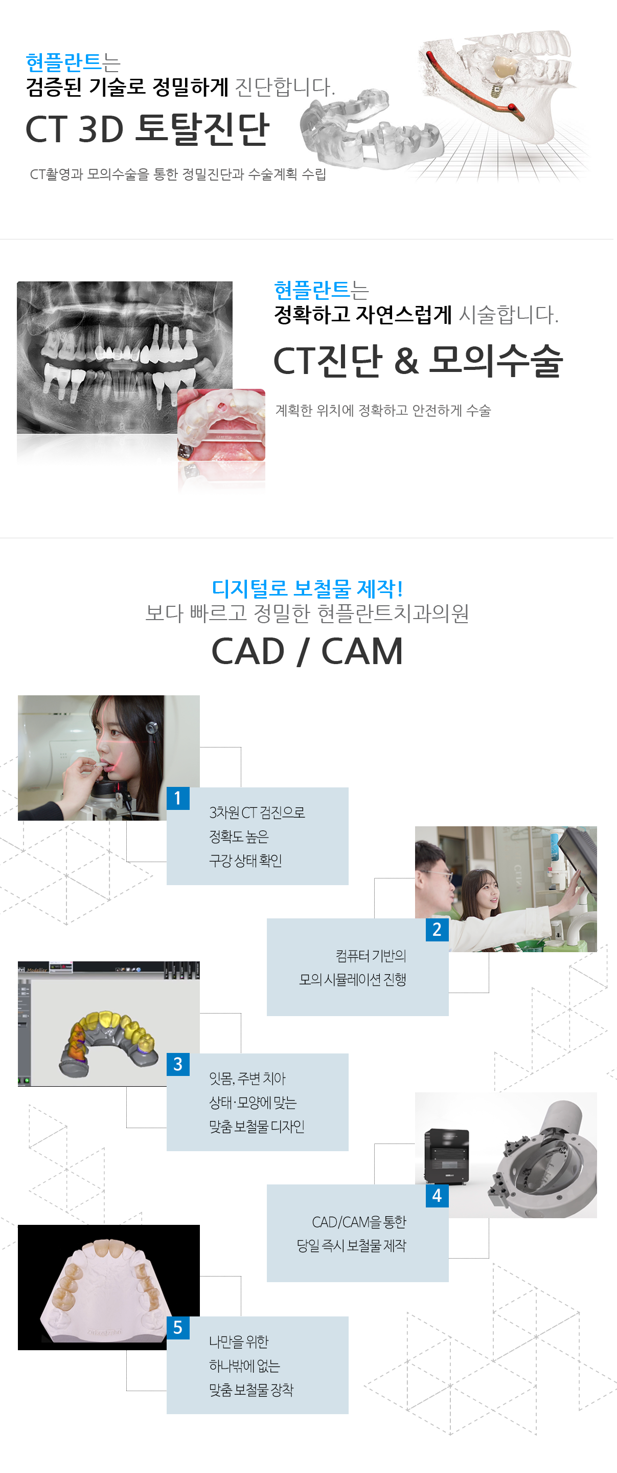 현플란트 치과소개 CT 3D토탈진단, CT진단 및 모의수술, 디지털 보철물제작 CAD/CAM